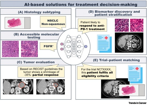 Artificial intelligence-based biomarkers for treatment decisions in oncology