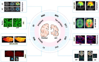 This review explores the latest advancements in imaging technologies for early Alzheimer's disease (AD) diagnosis, focusing on modalities such as PET, MRI, fluorescence imaging, and the integration of nanotechnology to enhance diagnostic accuracy and therapeutic potential. It also highlights the role of artificial intelligence and multimodal imaging in shaping the future of non-invasive, personalized AD diagnostics.