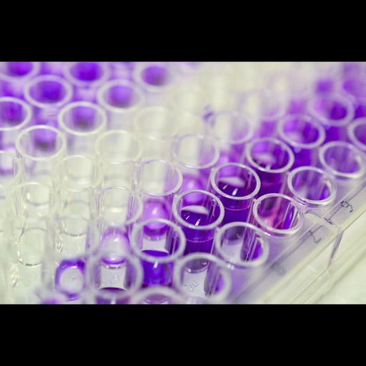 [0812-SLY4195Hu-96T] Human Botulinum toxin E（ BTXsize:E）ELISA Kit size: 96 Tests
